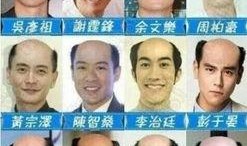 男明星脱发爆料视频,脱发视频曝光，明星脱发现状引关注
